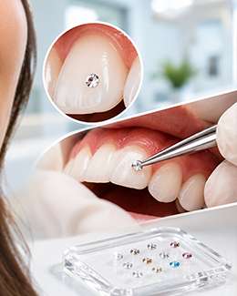 Dental Jewellery at Dr. Zahers Aesthetic Dental Center, Al Jurf, Ajman